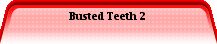Busted Teeth 2